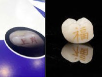 “牙齿文身”风靡齿科？牙冠个性化刻印“发财”“上岸”等字样，医生：不建议临床使用